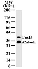 FOSB Antibody (aa2-15, clone 83B1138)