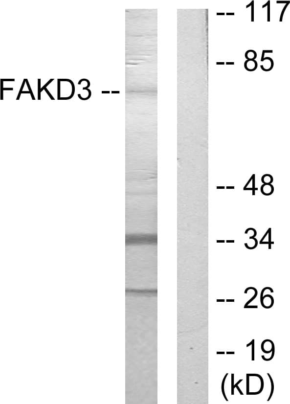 FASTKD3 Antibody (aa121-170)