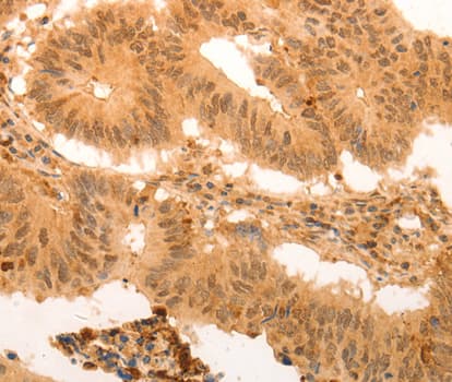 Polyclonal Rabbit anti-Human SUMO4 Antibody (IHC, WB)