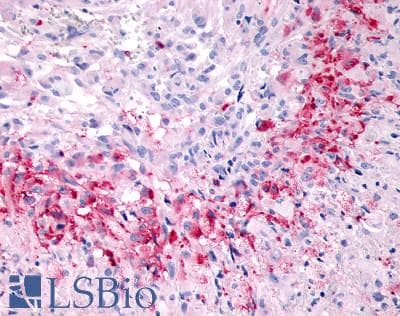 PathPlus™ ADGRD1 / GPR133 Antibody (N-Terminus)