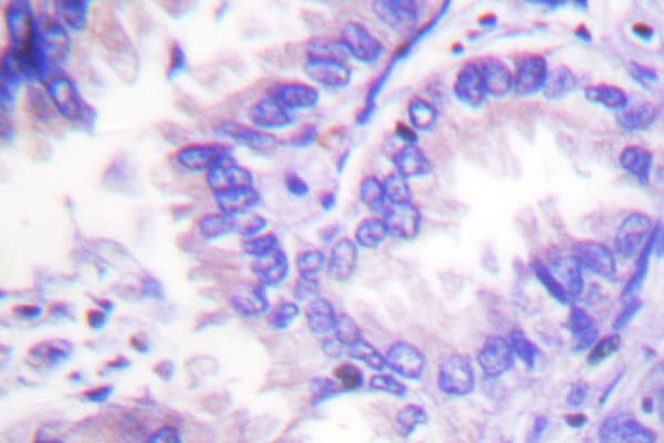 Polyclonal Rabbit anti-Human PP2Ac / PPP2CA Antibody (Thr301, IHC, IF, WB)