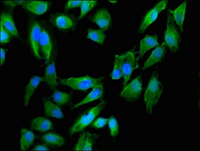 Polyclonal Rabbit anti-Human Dystonin / BPAG1 Antibody (IF)