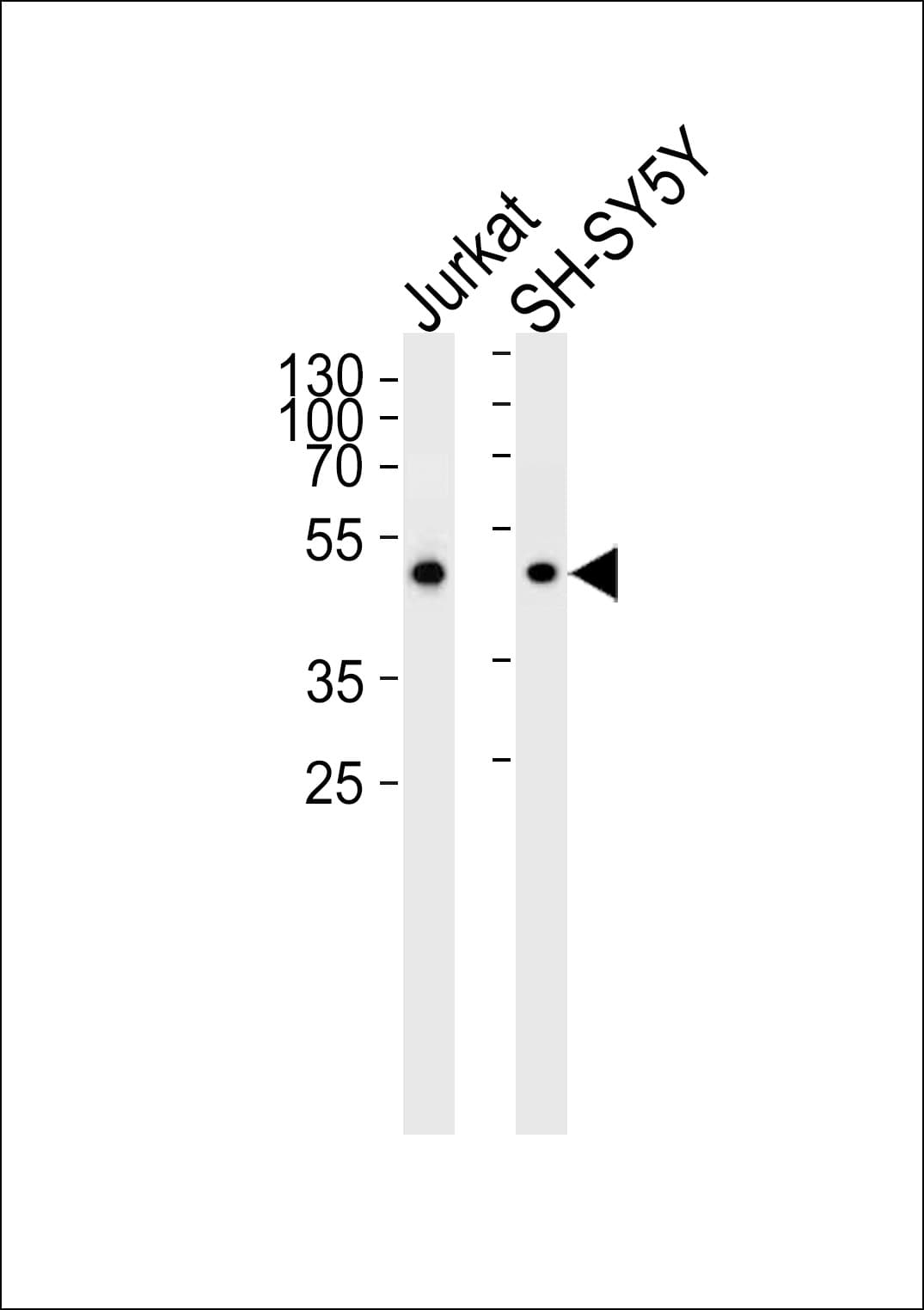 ANXA7 / Annexin VII / SNX Antibody (aa 329-356, Internal)
