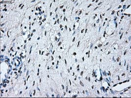 BRAF / B-Raf Antibody (clone OTI4C11)