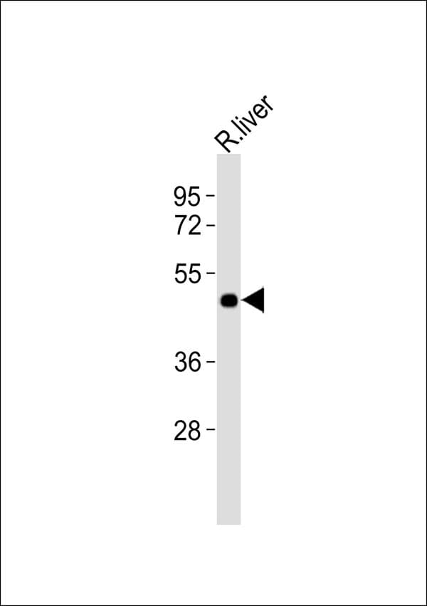 Polyclonal Rabbit anti-Human FFAR3 / GPR41 Antibody (WB)