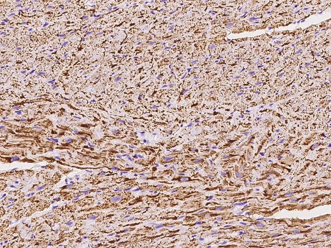 Polyclonal Rabbit anti-Human NDUFB5 Antibody (IHC, IF)