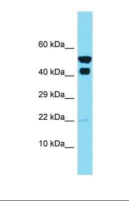 IKBIP Antibody (N-Terminus)