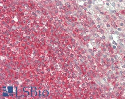 BCHE / Cholinesterase Antibody (aa29-150)