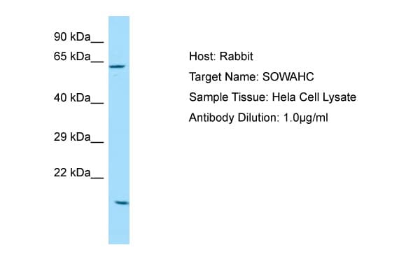 SOWAHC / ANKRD57 Antibody (aa425-474)