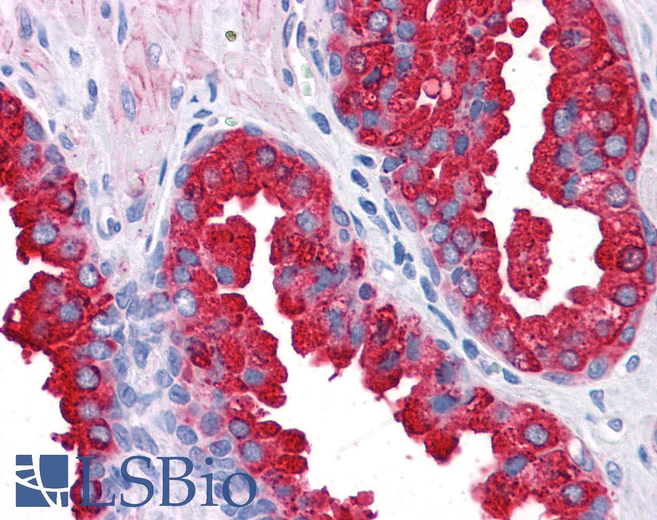 IHC-plus™ ERG Antibody