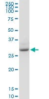 YWHAZ / 14-3-3 Zeta Antibody (clone 1B3)