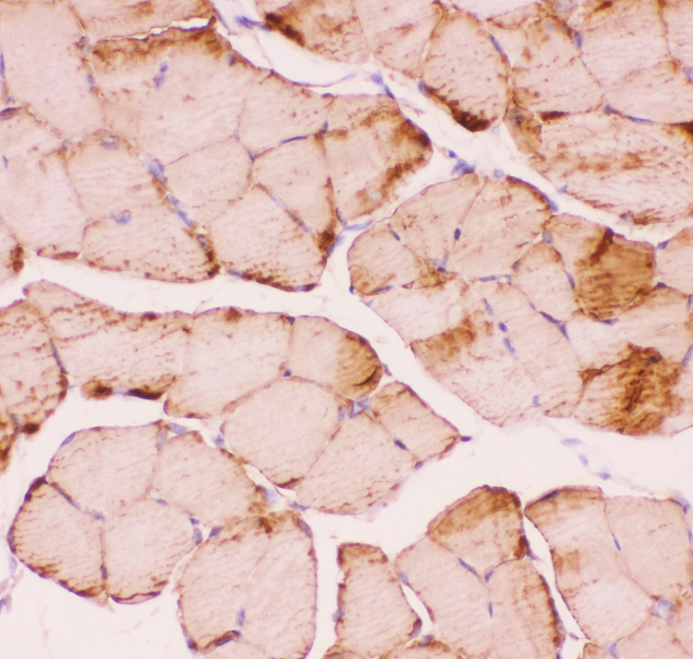 Polyclonal Rabbit anti-Human DES / Desmin Antibody (aa1-304, IHC, WB)