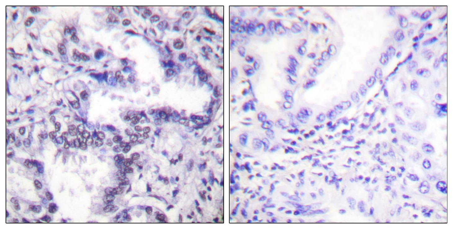 XRCC5 / Ku80 Antibody (phospho-Thr714)