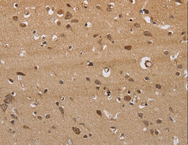 Polyclonal Rabbit anti-Human ITPR3 Antibody (IHC)