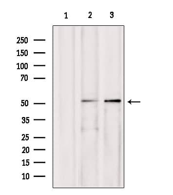 AEBP2 Antibody
