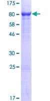 Human WDR1 Protein (Recombinant GST)