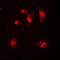 SKP2 Antibody (C-Terminus)