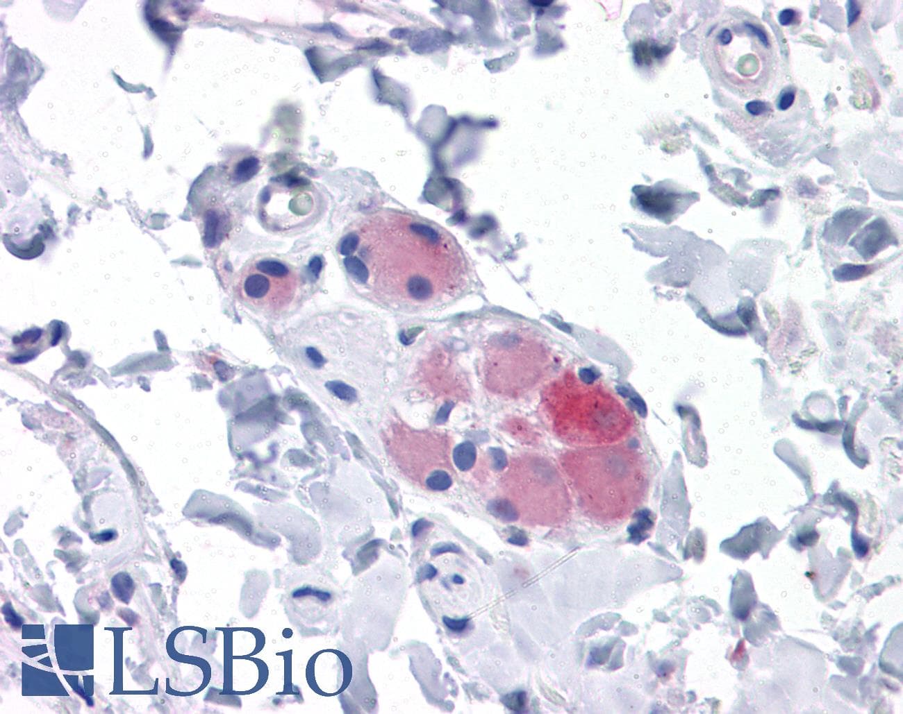 IHC-plus™ Monoclonal Mouse anti-Human GOK / STIM1 Antibody (clone 5A2, IHC, IF, WB)