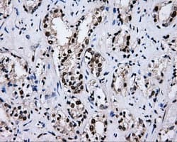 Monoclonal Mouse anti-Human RIP1 / RALBP1 Antibody (clone OTI11B2, IHC, IF, WB)