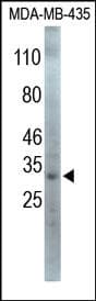 SNAI1 / SNAIL-1 Antibody