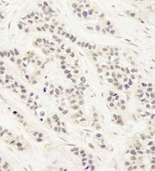 DCLRE1C / Artemis Antibody (aa650-C-term)