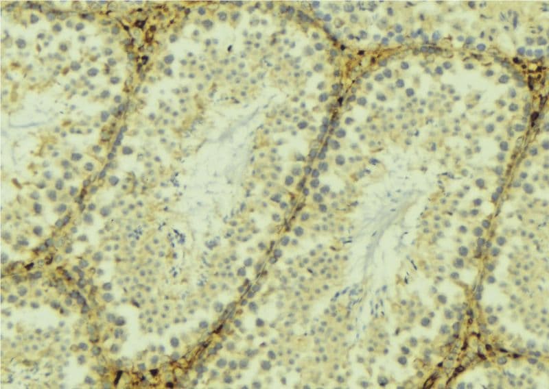 Polyclonal Rabbit anti-Human TXNRD2 Antibody (IHC, IF, WB)