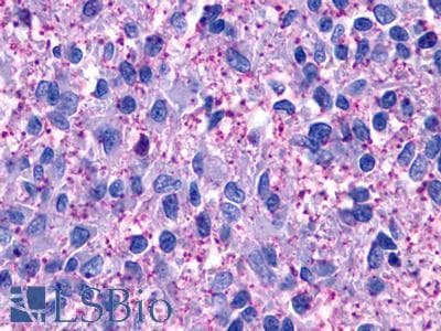 PathPlus™ GPR152 Antibody (C-Terminus)