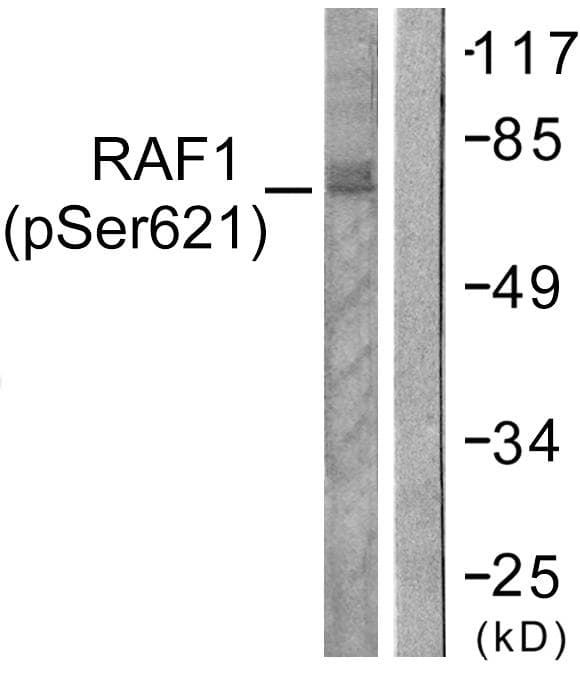 Polyclonal Rabbit anti-Human RAF1 / RAF Antibody (phospho-Ser621, IHC, IF, WB)