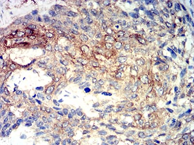 PRKAA2 / AMPK Alpha 2 Antibody (clone 5B4G1)