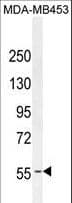 ER Alpha / Estrogen Receptor Antibody