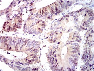 PBK / TOPK Antibody (clone 2C8)