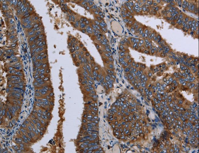 LZTFL1 Antibody
