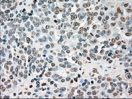 CHEK2 / CHK2 Antibody (clone OTI4C10)
