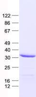 Human SLC25A38 Protein (Recombinant His, N-Terminal)