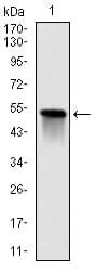 GSTM1 Antibody (clone 1H4A4)