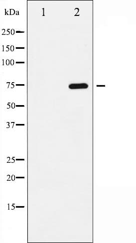 RELA / NFKB p65 Antibody (phospho-Ser468)