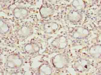 DENND5A Antibody
