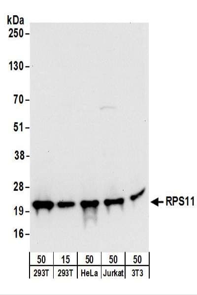 RPS11 / Ribosomal Protein 11 Antibody (aa1-50)