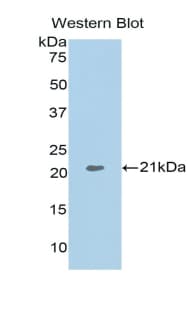 ARPC4 Antibody (aa3-163)
