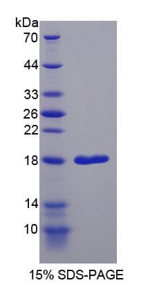 Rat REG1A Protein (Recombinant His-S)