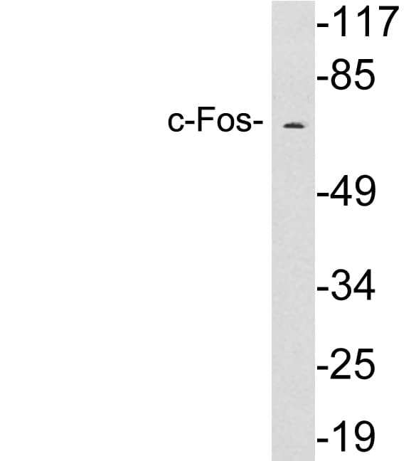 Polyclonal Rabbit anti-Human FOS / c-FOS Antibody (aa269-318, WB)