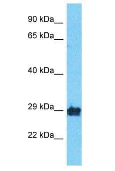 OR10A2 Antibody (aa231-280)