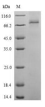 Arabidopsis thaliana CAT2 Protein (Recombinant 6His-SUMO, N-terminus)