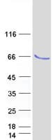Human TRMT61B Protein (Recombinant Myc-DDK (Flag))