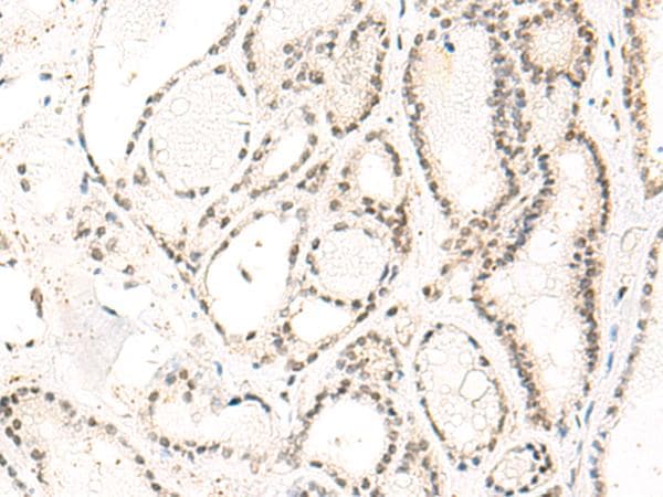 DUT / DUTPase Antibody