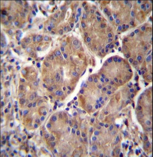 Polyclonal Rabbit anti-Human MMRN2 / Emilin 3 / EndoGlyx-1 Antibody (aa768-797, IHC, WB)