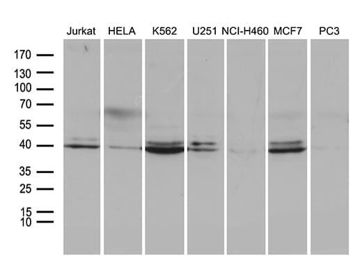 NFKBIE / IKB Epsilon Antibody (clone OTI4D1)