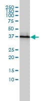 Monoclonal Mouse anti-Human PSMD7 / MOV34 Antibody (clone 2G5, WB)