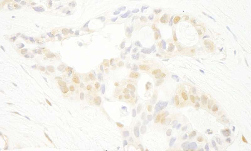 PRPF4B Antibody (aa1-50)