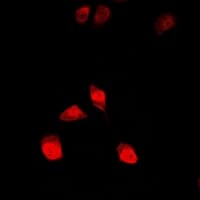 IHC-plus™ ALOX15B / 15-LOX-2 Antibody